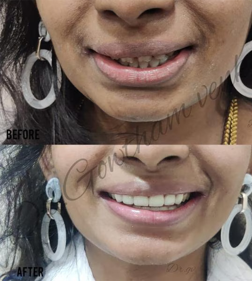 Dental Clinic Near Me Vadapalani, Chennai