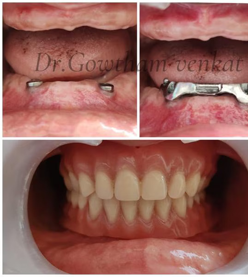 Kids Dentist Near Me